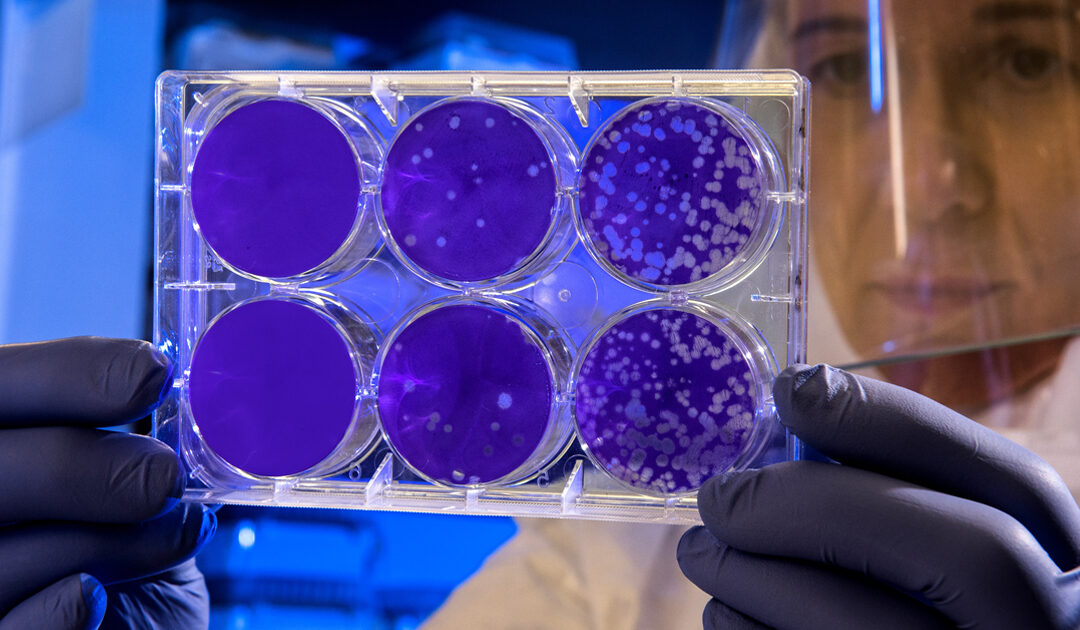 How Long Coronavirus Survives on Surfaces